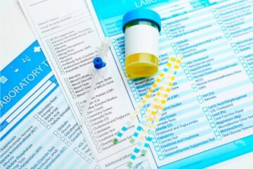 運動能力の低下は腎機能悪化指標L-FABPの上昇と関連する